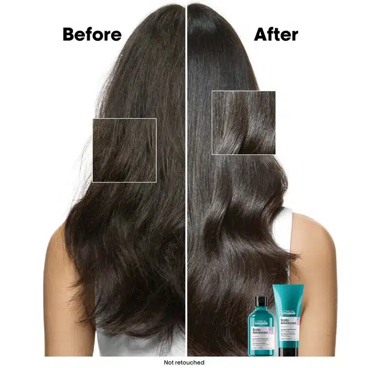 Scalp Advanced Anti-Discomfort Shampoo Refill Kit - 500 mL - Image 3